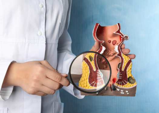 Fissures, Fistulas, & Hemorrhoids Treatment Thumbnail